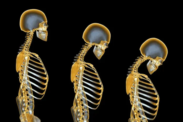 Calcium Intake Basics for Stronger Bone Density